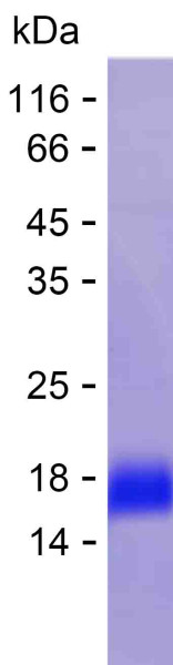 Recombinant Human KIR2DS5 Protein