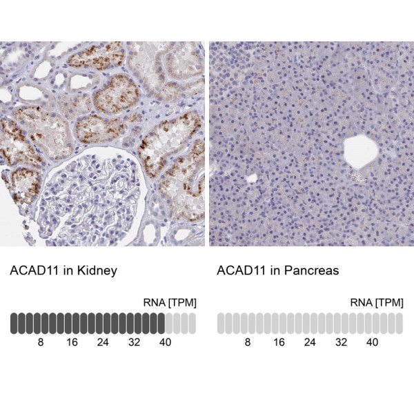 Anti-ACAD11
