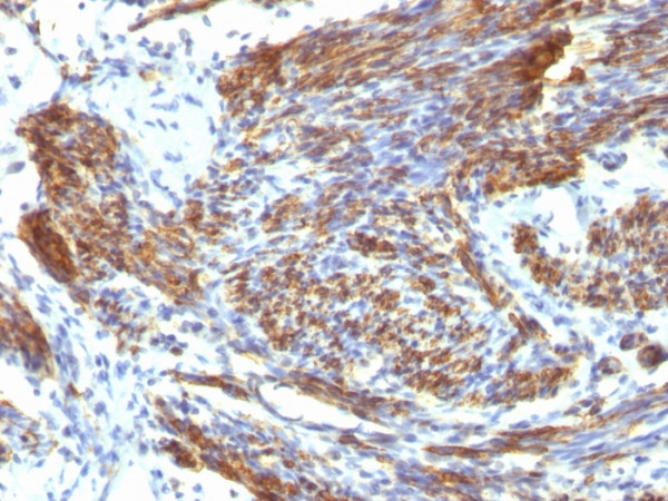 Anti-Caldesmon, HMW (h-Caldesmon) (Smooth Muscle Marker), clone CALD1/820