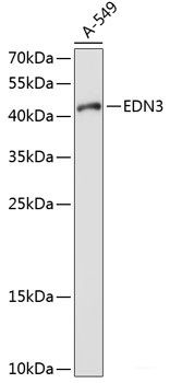 Anti-EDN3