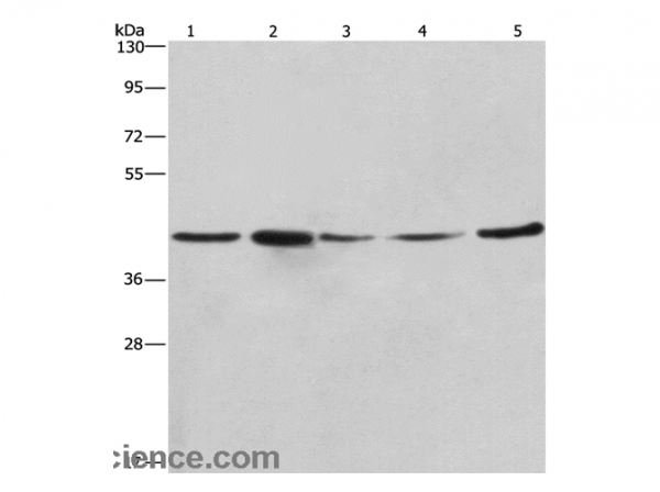 Anti-RPSA