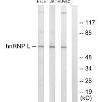 Anti-HNRNPL
