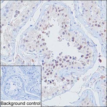 Anti-ERCC1