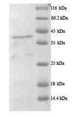 A disintegrin and metalloproteinase with thrombospondin motifs 7 (ADAMTS7), partial, human, recombin