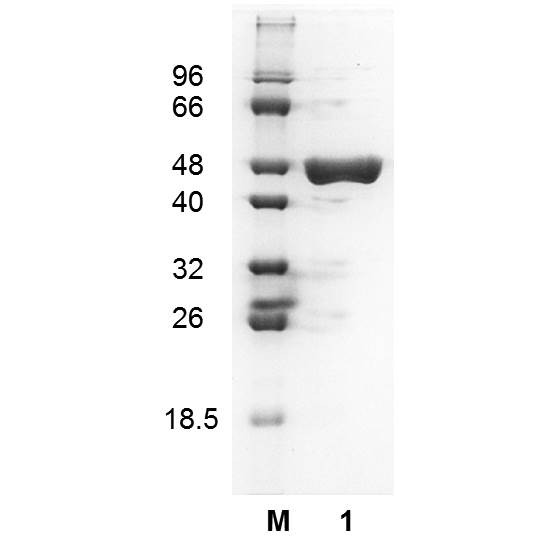 Glutamate dehydrogenase (EC 1.4.1.4), Escherichia coli