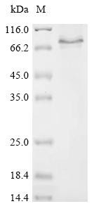 Reticulophagy regulator 1 (Retreg1), recombinant rat