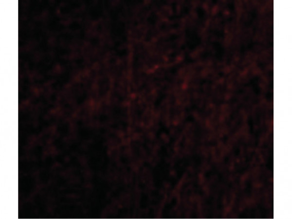 Anti-Plxdc2