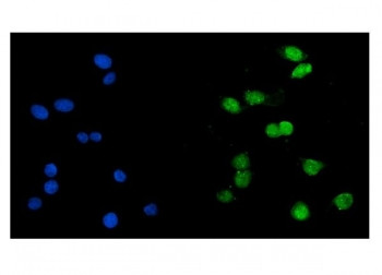 Anti-Histone acetyltransferase 1 / HAT1 / KAT1