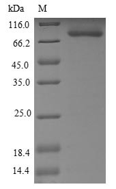 ATP-dependent DNA helicase Q1 (RECQL), human, recombinant