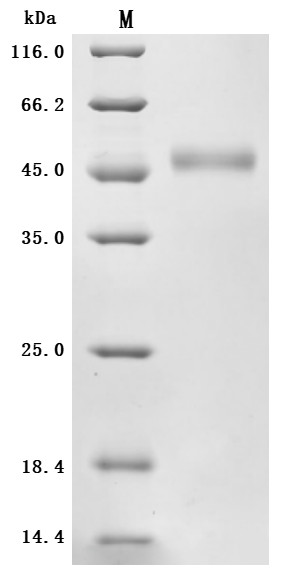 Zinc transporter ZIP6 (SLC39A6), partial (Active), human, recombinant