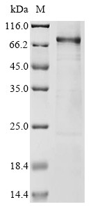 Nucleolar transcription factor 1 (UBTF), partial, human, recombinant
