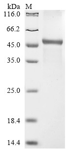 Collagen alpha-2 (VI) chain(COL6A2), partial, human, recombinant