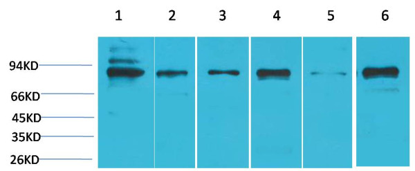Anti-STAT5b