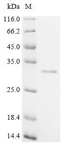Epstein-Barr nuclear antigen 2 (EBNA2), partial, recombinant Epstein-Barr virus