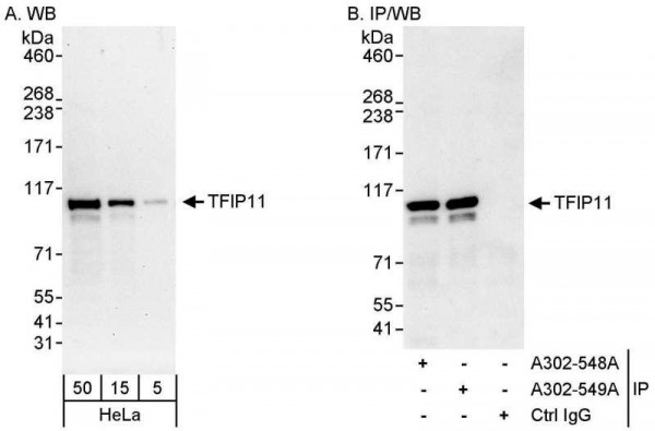 Anti-TFIP11