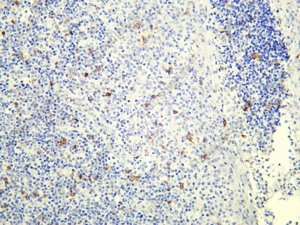 Anti-Recombinant Integrin alphaE, clone C112188