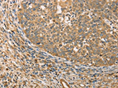 Anti-ATG3