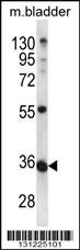 Anti-METTL11B, NT (METTL11B, C1orf184, Alpha N-terminal protein methyltransferase 1B, Methyltransfer