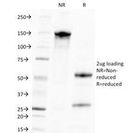 Anti-Cytomegalovirus p65, clone CMV100