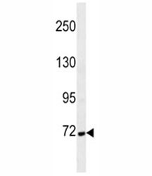 Anti-Cortactin, clone 401CT8.6.3