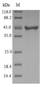Visinin-like protein 1 (VSNL1), human, recombinant