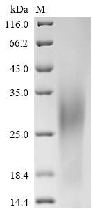Glucose-6-phosphatase (G6PC), partial, human, recombinant