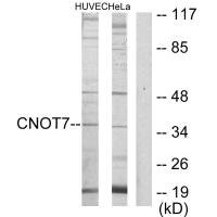 Anti-CNOT7