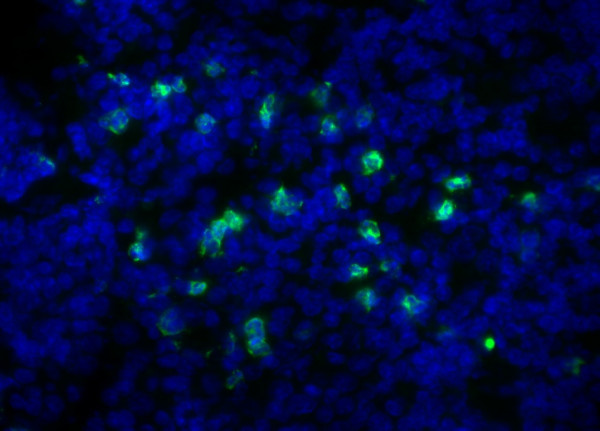 Anti-Ly6G + Ly6C, clone RB6-8C5