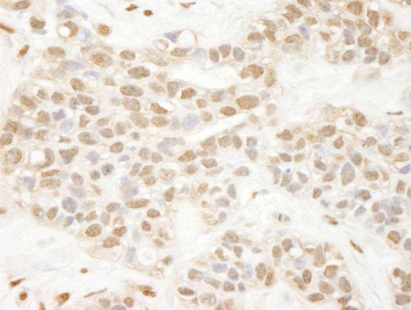 Anti-Pc2 (IHC)