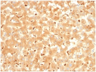 Anti-Alpha-2-Macroglobulin, clone A2M/3621