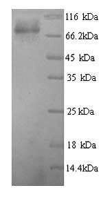 Glucokinase regulatory protein (GCKR), human, recombinant