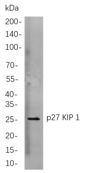 Anti-Recombinant p27 KIP 1, clone 3P8