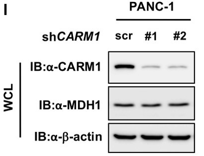 Anti-PRMT4 / CARM1, clone 2B9-H11-H10