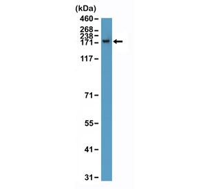 Anti-CPS1 / Carbamoyl phosphate synthetase 1 (recombinant antibody), clone RM395