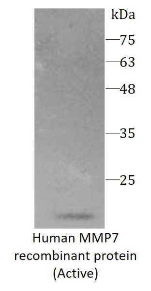 Human MMP7 recombinant protein (Active) (His-tagged)