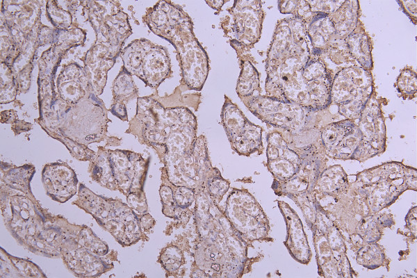 Anti-ENTPD1, recombinant clone 5D3
