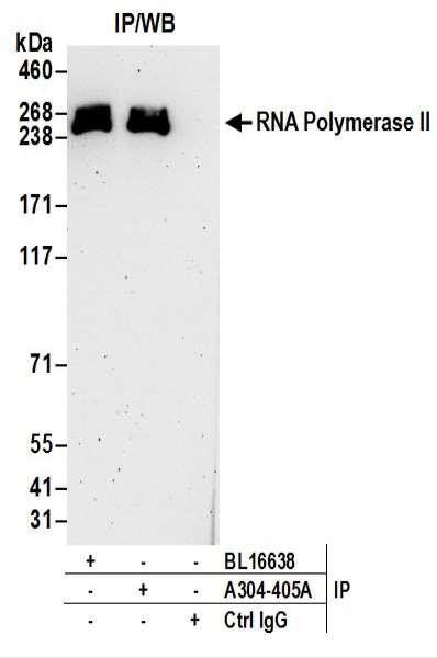 Anti-RNA Polymerase II