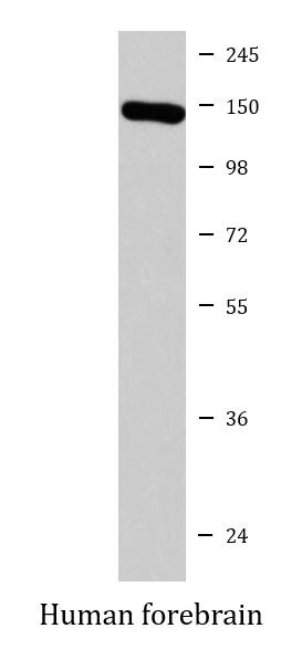 Anti-NrCAM