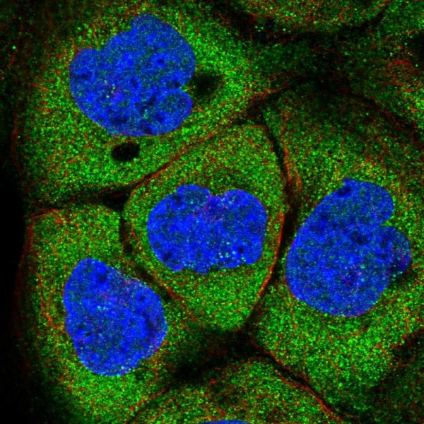Anti-NCBP1