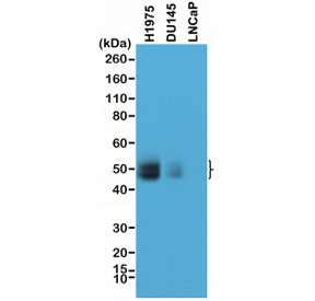Anti-PD-L1 / B7-H1 / CD274, clone RM320