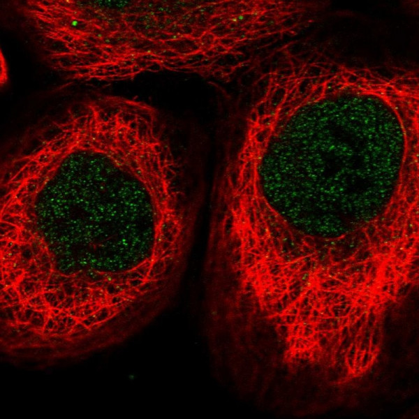 Anti-RSPH4A
