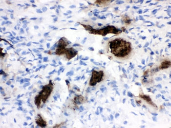 Anti-Osteocalcin
