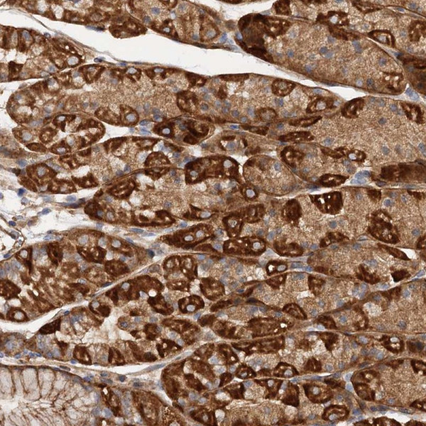 Anti-CSAD