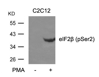 Anti-phospho-eIF2 beta (Ser2)