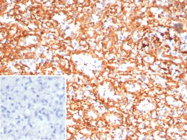 Anti-ADCY8 (Adenylate Cyclase 8), clone ADCY8/7574