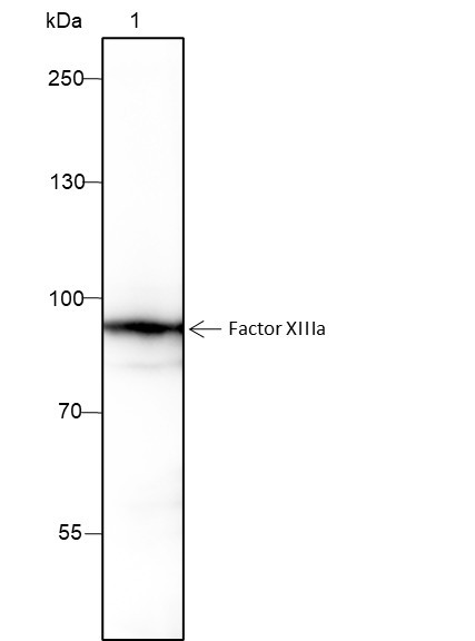 Anti-Recombinant Factor XIIIa, clone A218