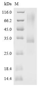 Sclerostin (SOST), Biotinylated, human, recombinant