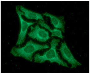 Anti-Laforin, clone k2A3