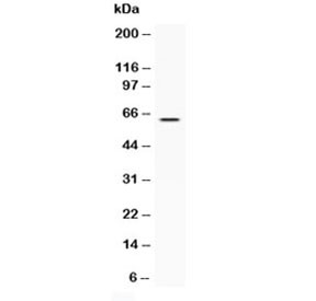 Anti-LBP / Lipopolysaccharide Binding Protein