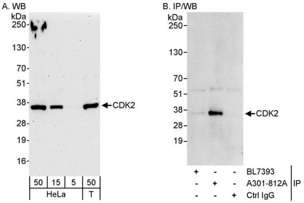 Anti-CDK2